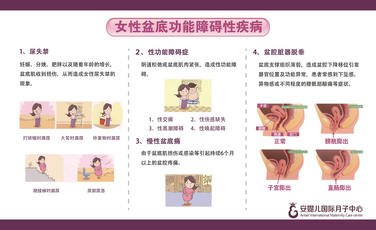 女性盆底功能障碍性疾病.jpg